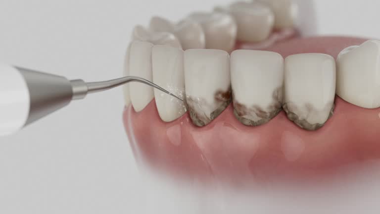 Reliable Dental Implants contractor in Anacoco, LA by Smile Center Dentistry
